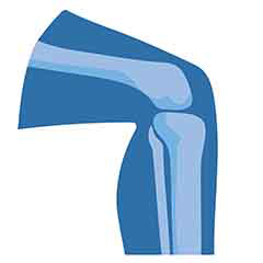 Santé des articulations et des os