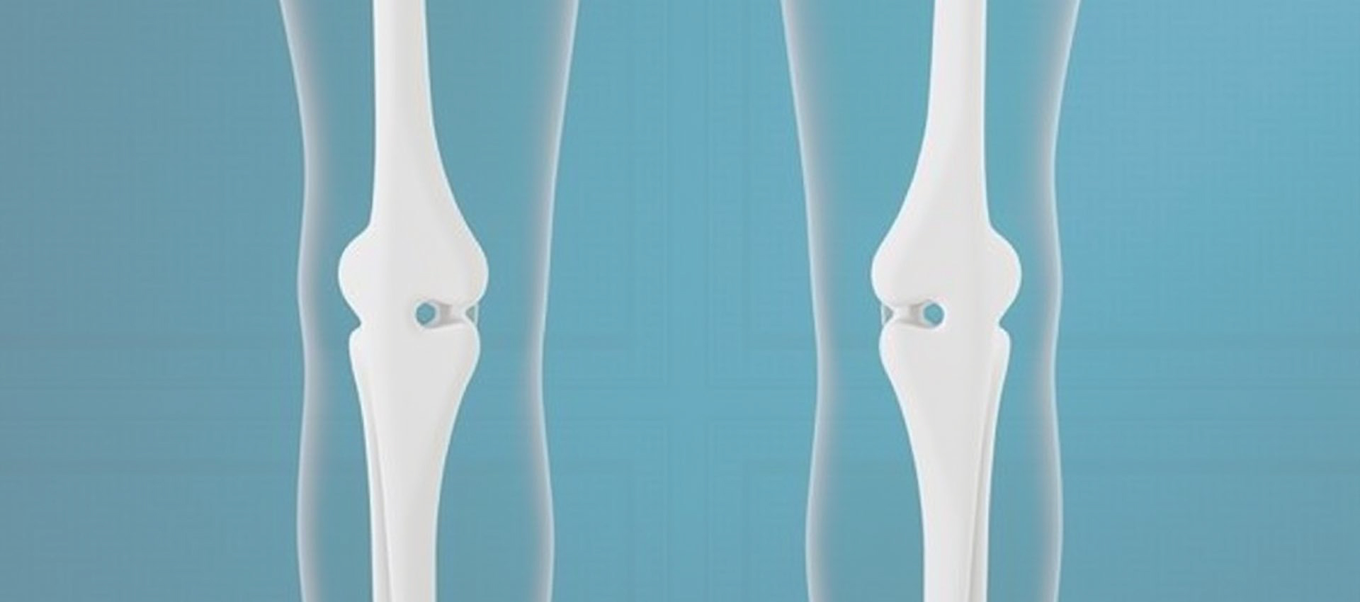 Vitamine Liposomale D3