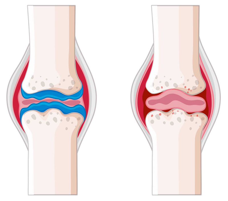 Favorise la santé des os et des maladies cardiovasculaires